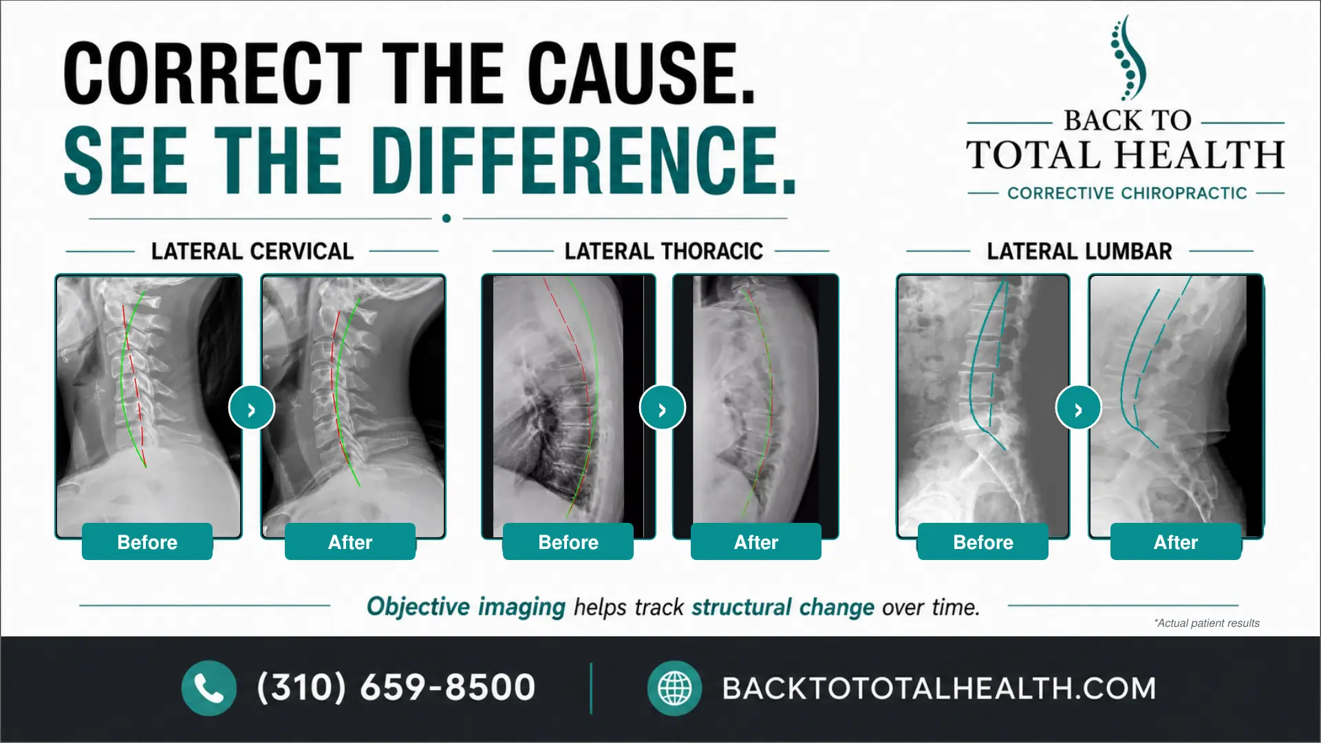 Comparative cervical, thoracic, and lumbar X-ray studies