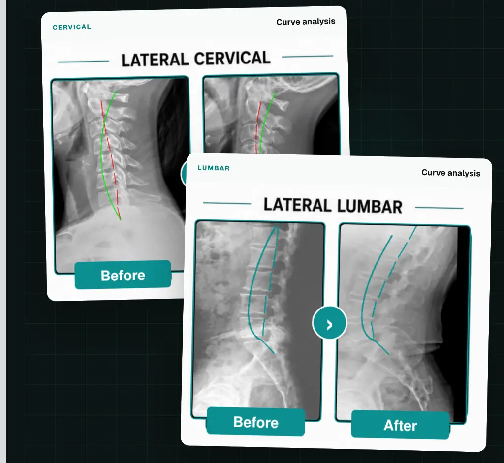 Cervical and lumbar curve analysis with comparative patient imaging