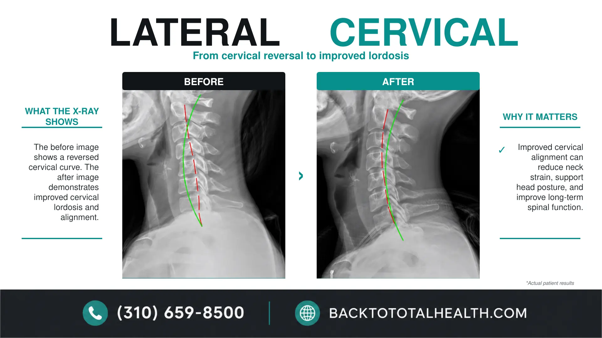 Comparative lateral cervical X-rays used in structural neck evaluation